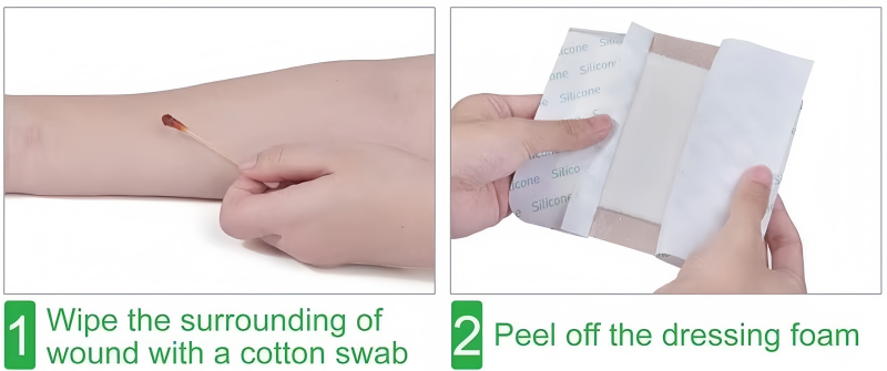 Silicone Foam Dressing