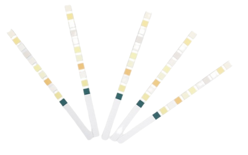 Urinalysis Reagent Strips (URS) Urinalysis Reagent Strips (URS)