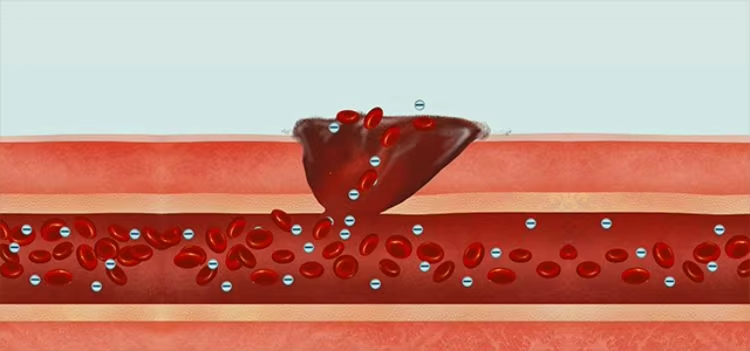 Emergency Tactical Military HIgh Performance Chitosan Hemostatic Granule