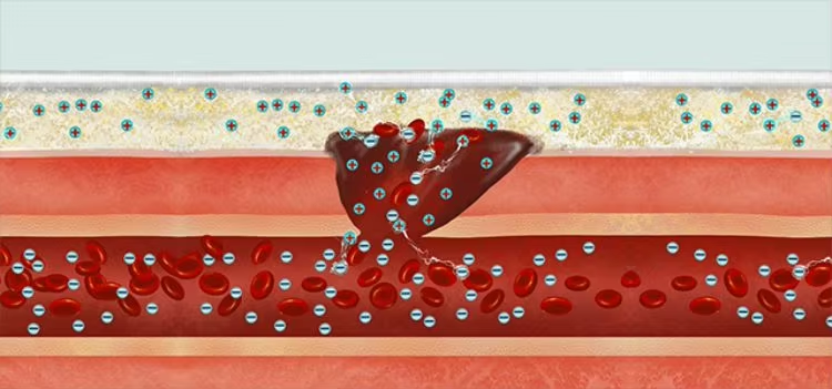 Emergency Tactical Military HIgh Performance Chitosan Hemostatic Granule