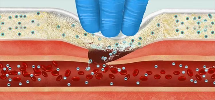Emergency Tactical Military HIgh Performance Chitosan Hemostatic Granule