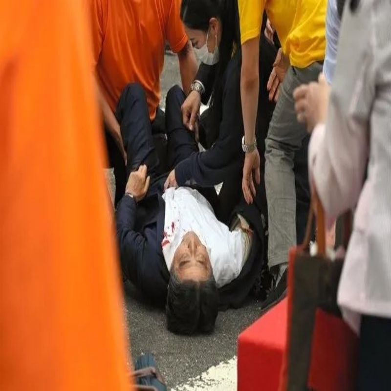 Was Shinzo Abe Really Killed by Gunshot?